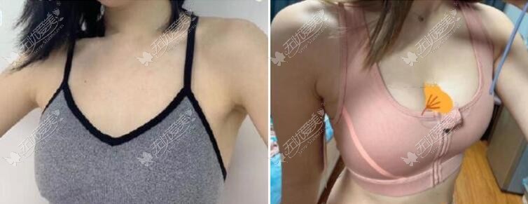 曼托225cc和250效果图